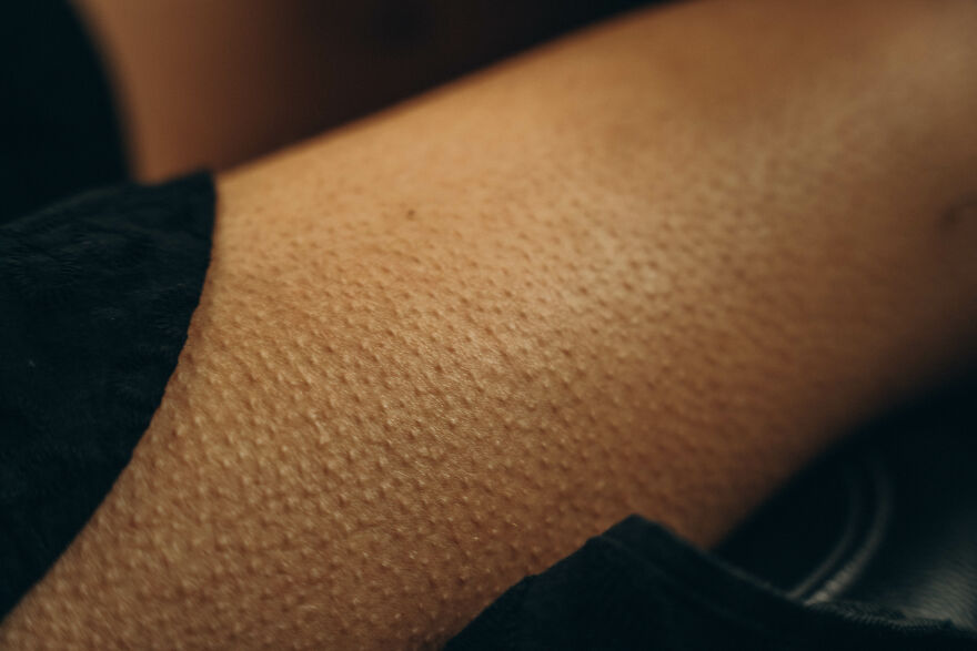 Trypophobia Explained: Why Your Brain Reacts To Tiny Holes Trypophobia Explained: Why Your Brain Reacts To Tiny Holes