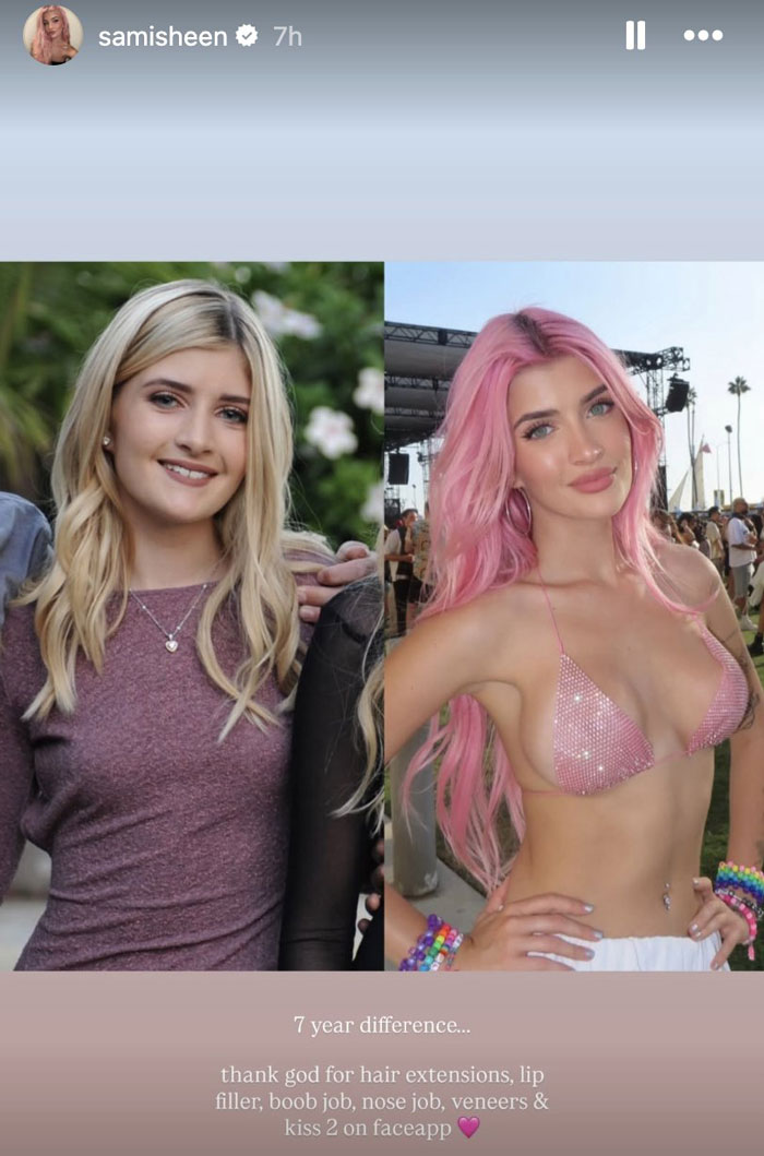 Charlie Sheen&#8217;s Daughter Posts Shocking Before-And-After Photos Revealing All Her Plastic Surgeries