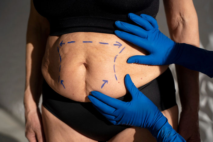 Husband Calls His Wife &#8220;Selfish And Vain&#8221; For Choosing Surgery Over Having Another Baby