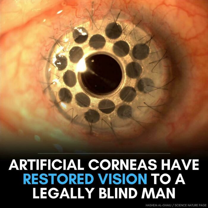 80 Pics That Are Weirdly Uncomfortable Even If You Don’t Suffer From Trypophobia (New Pics)