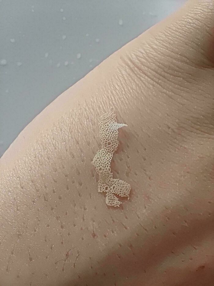 80 Pics That Are Weirdly Uncomfortable Even If You Don’t Suffer From Trypophobia (New Pics)