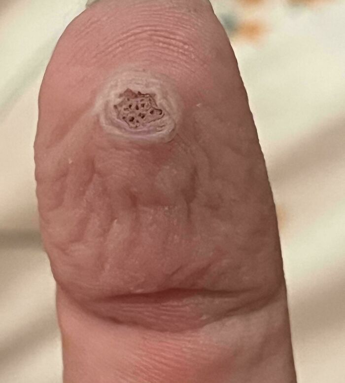 80 Pics That Are Weirdly Uncomfortable Even If You Don’t Suffer From Trypophobia (New Pics)