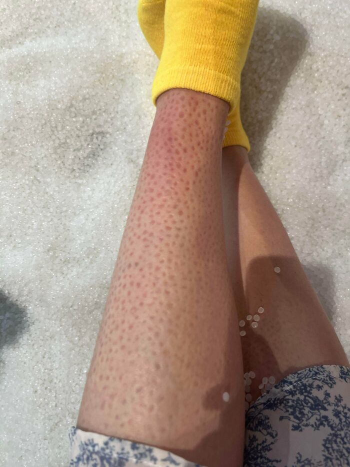 80 Pics That Are Weirdly Uncomfortable Even If You Don’t Suffer From Trypophobia (New Pics)