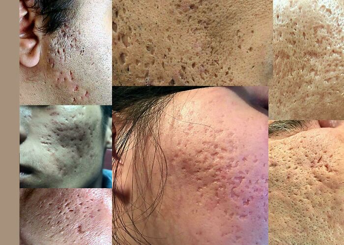 80 Pics That Are Weirdly Uncomfortable Even If You Don’t Suffer From Trypophobia (New Pics)