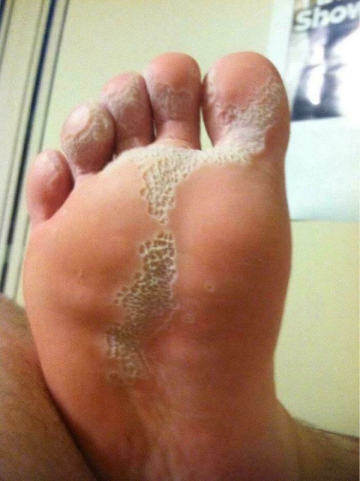 80 Pics That Are Weirdly Uncomfortable Even If You Don’t Suffer From Trypophobia (New Pics)