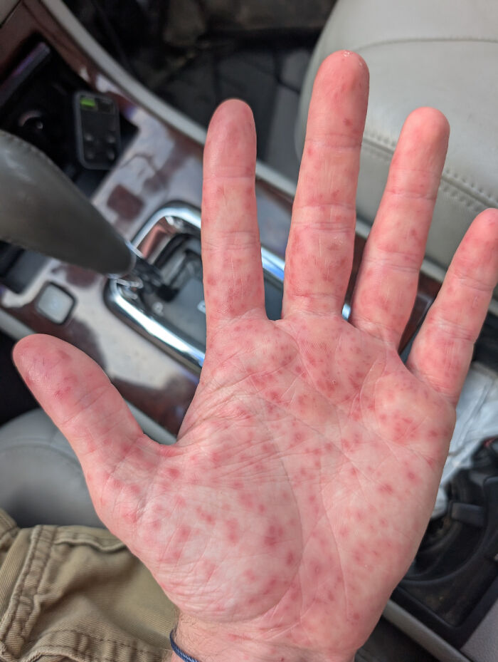 80 Pics That Are Weirdly Uncomfortable Even If You Don’t Suffer From Trypophobia (New Pics)