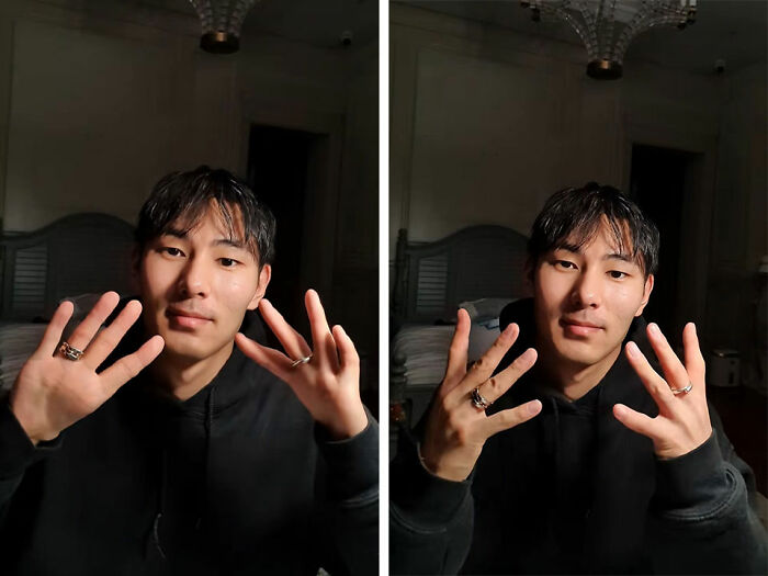 Thumbless Man Goes Mega Viral For His Ingenious Life Hacks That Stunned The Internet