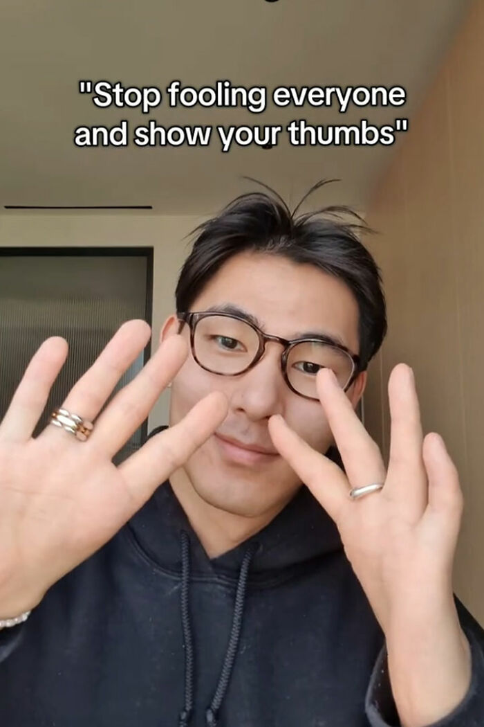 Thumbless Man Goes Mega Viral For His Ingenious Life Hacks That Stunned The Internet