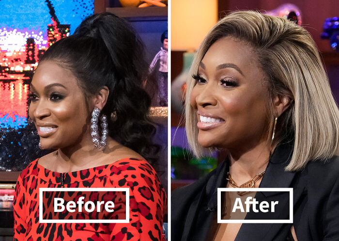 19 Celebrities Who Look Noticeably Better After Hair Transplants