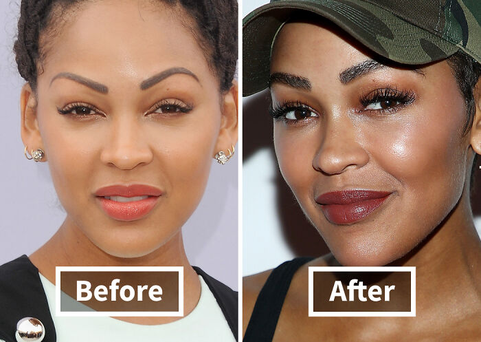 19 Celebrities Who Look Noticeably Better After Hair Transplants