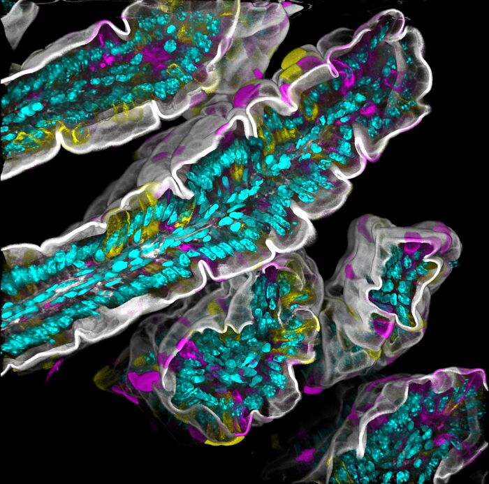 71 Mind-Blowing Microscopic Images From The 2025 Nikon Small World Photomicrography Contest