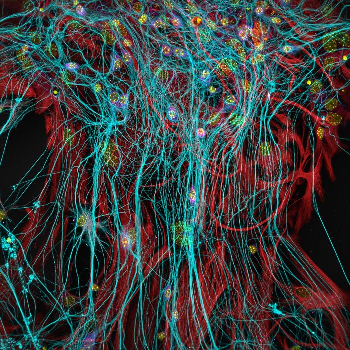 71 Mind-Blowing Microscopic Images From The 2025 Nikon Small World Photomicrography Contest