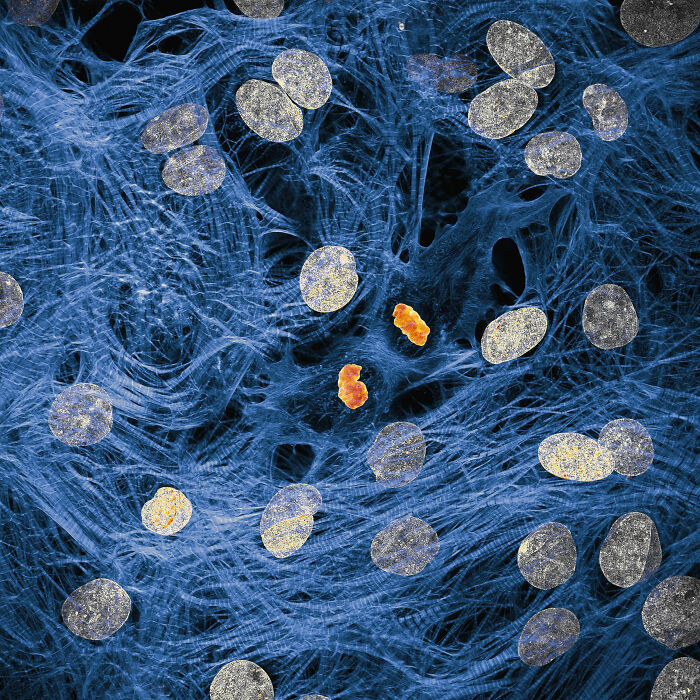 71 Mind-Blowing Microscopic Images From The 2025 Nikon Small World Photomicrography Contest