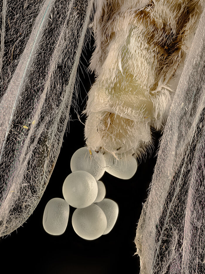 71 Mind-Blowing Microscopic Images From The 2025 Nikon Small World Photomicrography Contest