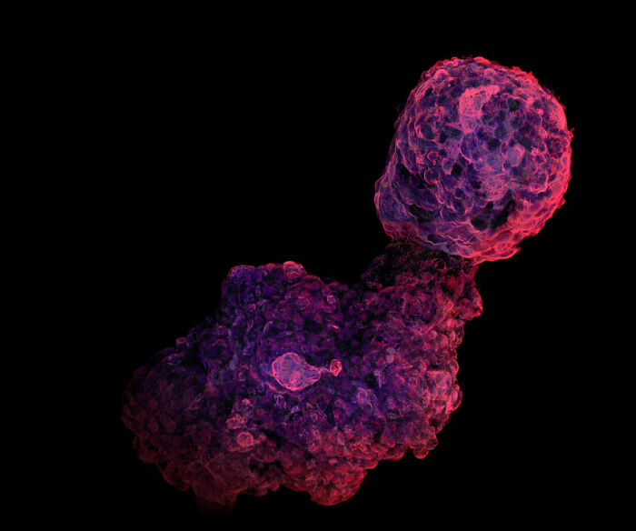 71 Mind-Blowing Microscopic Images From The 2025 Nikon Small World Photomicrography Contest