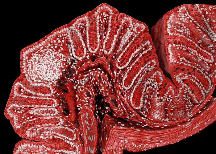 71 Mind-Blowing Microscopic Images From The 2025 Nikon Small World Photomicrography Contest