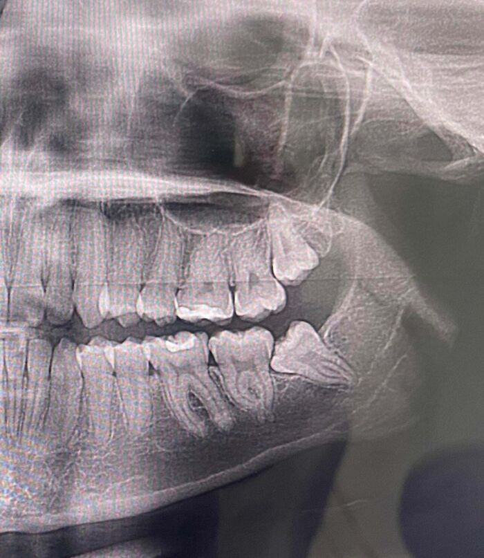 97 Pics That Expose The Harsh Realities Of American Healthcare