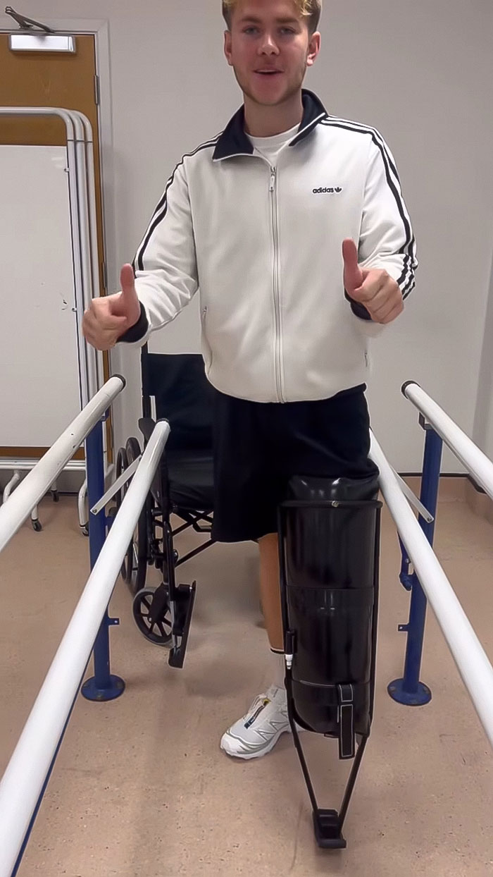 20-Year-Old Decided To Amputate His Leg After Going To A Rock Concert, Breaks His Silence On Why