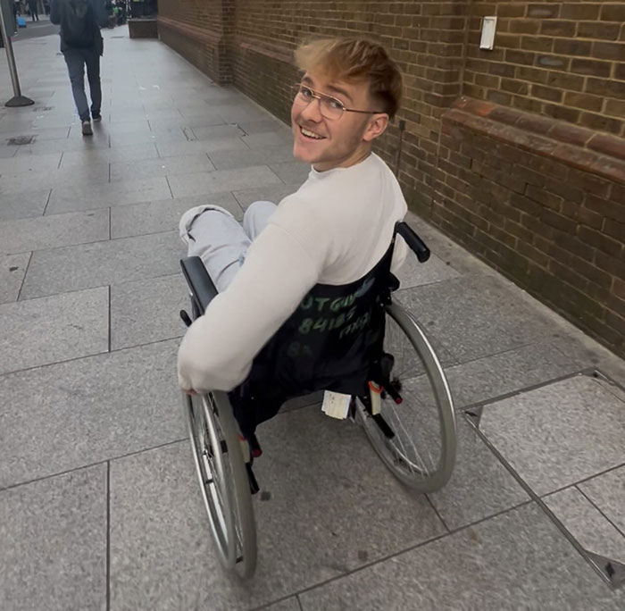 20-Year-Old Decided To Amputate His Leg After Going To A Rock Concert, Breaks His Silence On Why