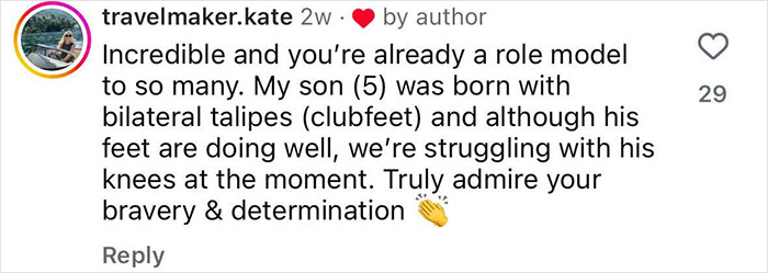 20-Year-Old Decided To Amputate His Leg After Going To A Rock Concert, Breaks His Silence On Why