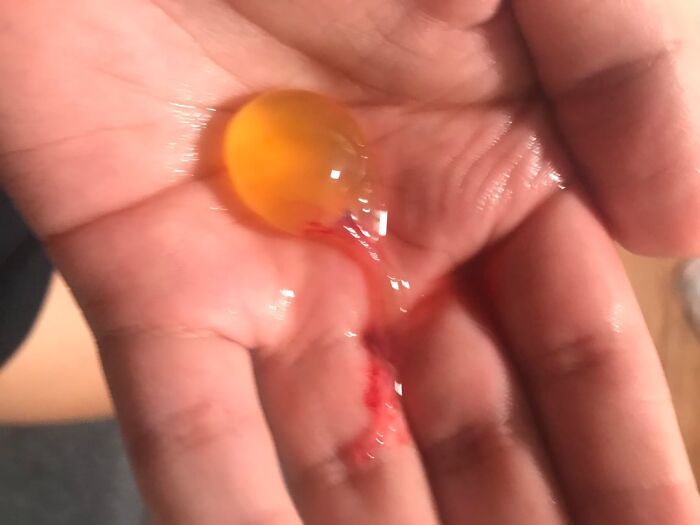 42 Medical Posts That Are Equal Parts Fascinating And Deeply Unsettling 42 Medical Posts That Are Equal Parts Fascinating And Deeply Unsettling