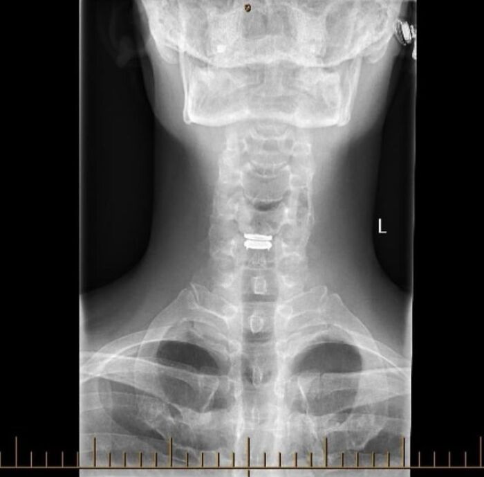 42 Medical Posts That Are Equal Parts Fascinating And Deeply Unsettling 42 Medical Posts That Are Equal Parts Fascinating And Deeply Unsettling