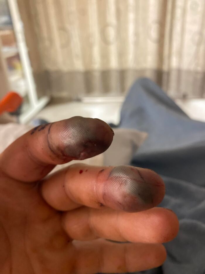 42 Medical Posts That Are Equal Parts Fascinating And Deeply Unsettling 42 Medical Posts That Are Equal Parts Fascinating And Deeply Unsettling