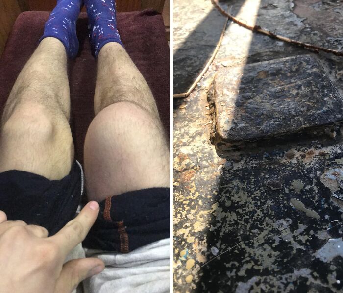 42 Medical Posts That Are Equal Parts Fascinating And Deeply Unsettling 42 Medical Posts That Are Equal Parts Fascinating And Deeply Unsettling