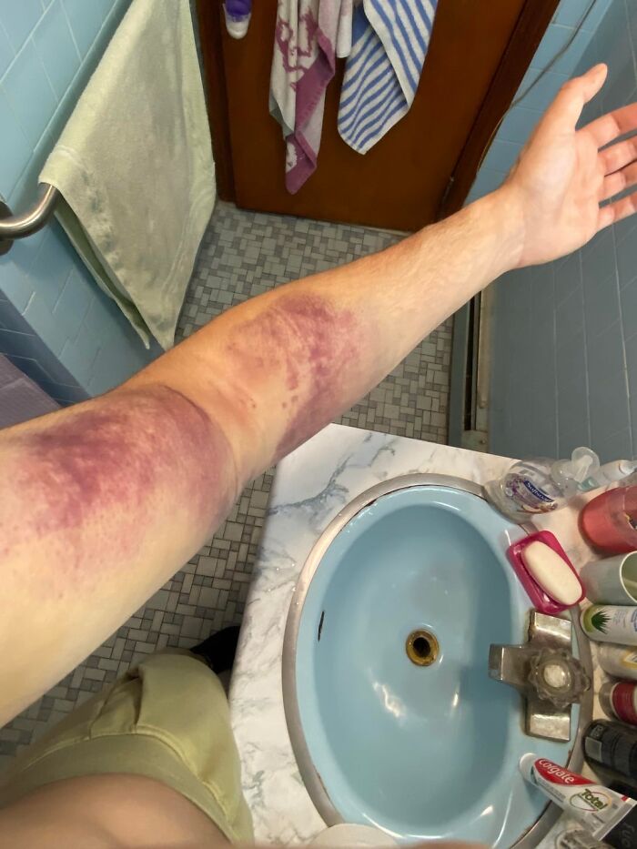 42 Medical Posts That Are Equal Parts Fascinating And Deeply Unsettling 42 Medical Posts That Are Equal Parts Fascinating And Deeply Unsettling