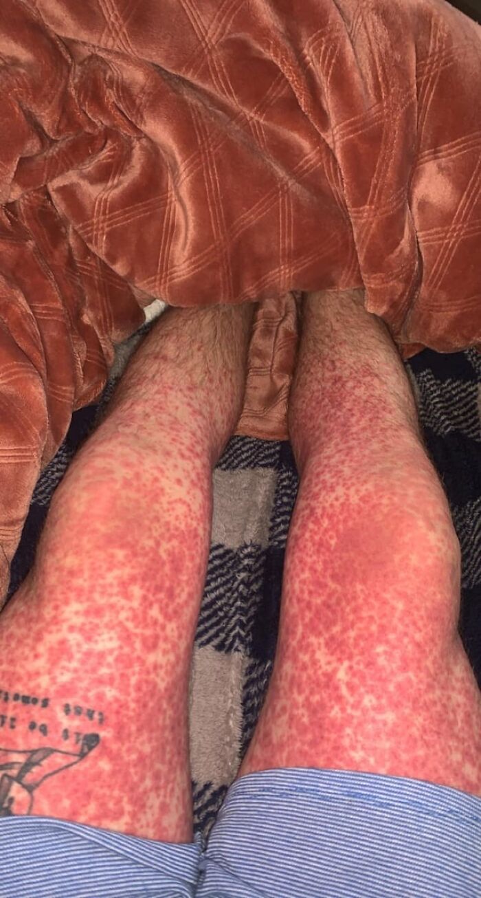 42 Medical Posts That Are Equal Parts Fascinating And Deeply Unsettling 42 Medical Posts That Are Equal Parts Fascinating And Deeply Unsettling