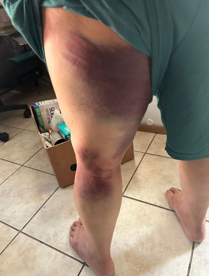 42 Medical Posts That Are Equal Parts Fascinating And Deeply Unsettling 42 Medical Posts That Are Equal Parts Fascinating And Deeply Unsettling