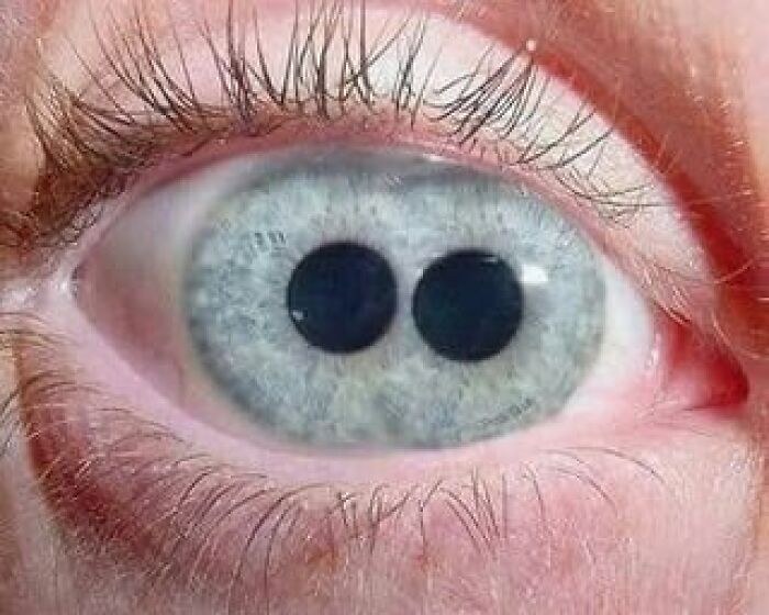 42 Medical Posts That Are Equal Parts Fascinating And Deeply Unsettling 42 Medical Posts That Are Equal Parts Fascinating And Deeply Unsettling