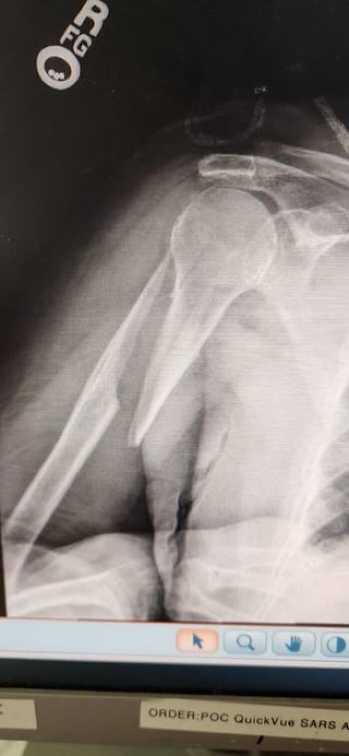 42 Medical Posts That Are Equal Parts Fascinating And Deeply Unsettling 42 Medical Posts That Are Equal Parts Fascinating And Deeply Unsettling