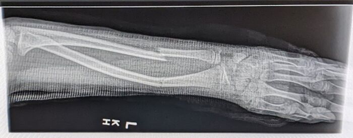 42 Medical Posts That Are Equal Parts Fascinating And Deeply Unsettling 42 Medical Posts That Are Equal Parts Fascinating And Deeply Unsettling