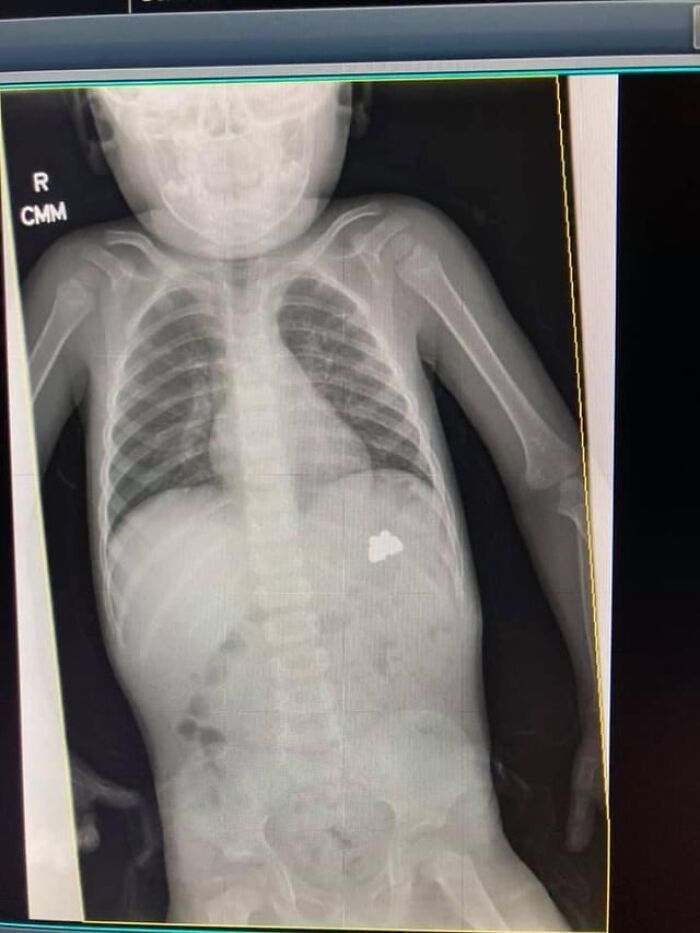 42 Medical Posts That Are Equal Parts Fascinating And Deeply Unsettling 42 Medical Posts That Are Equal Parts Fascinating And Deeply Unsettling