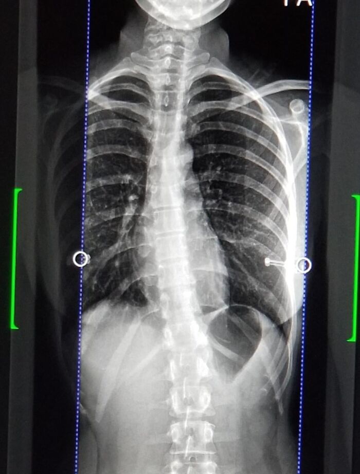 42 Medical Posts That Are Equal Parts Fascinating And Deeply Unsettling 42 Medical Posts That Are Equal Parts Fascinating And Deeply Unsettling