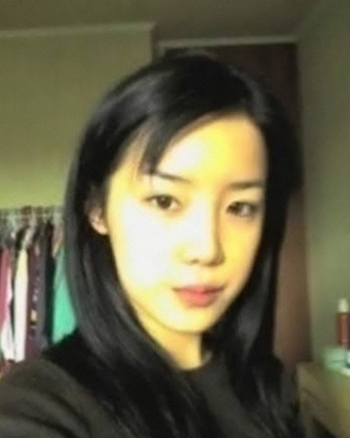 K-Pop Icon Park Bom Reveals Heartbreaking Reason Behind Drastic Plastic Surgery Transformation K-Pop Icon Park Bom Reveals Heartbreaking Reason Behind Drastic Plastic Surgery Transformation