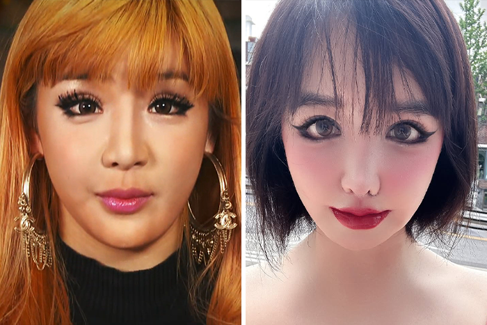K-Pop Icon Park Bom Reveals Heartbreaking Reason Behind Drastic Plastic Surgery Transformation K-Pop Icon Park Bom Reveals Heartbreaking Reason Behind Drastic Plastic Surgery Transformation