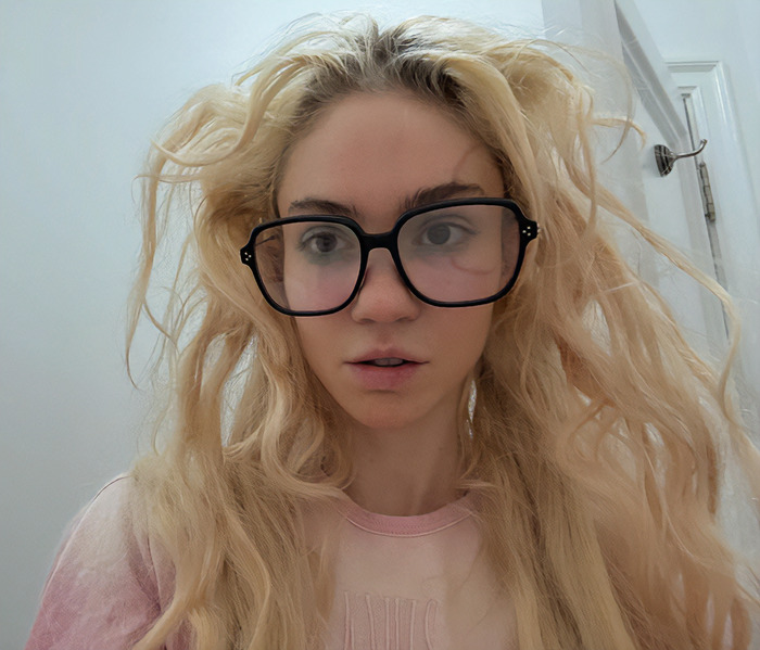 “Ringworm”: Elon Musk’s Ex Grimes Stuns Fans With “Insane” Face Tattoo “Ringworm”: Elon Musk’s Ex Grimes Stuns Fans With “Insane” Face Tattoo