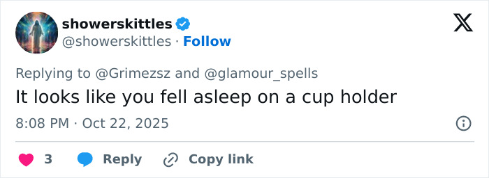 “Ringworm”: Elon Musk’s Ex Grimes Stuns Fans With “Insane” Face Tattoo “Ringworm”: Elon Musk’s Ex Grimes Stuns Fans With “Insane” Face Tattoo