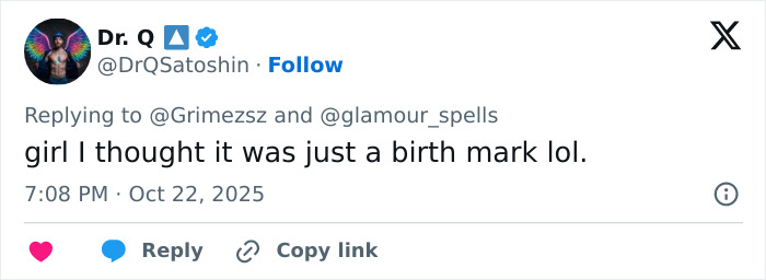 “Ringworm”: Elon Musk’s Ex Grimes Stuns Fans With “Insane” Face Tattoo “Ringworm”: Elon Musk’s Ex Grimes Stuns Fans With “Insane” Face Tattoo