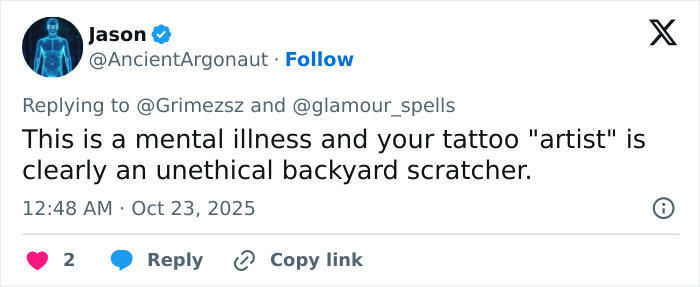 “Ringworm”: Elon Musk’s Ex Grimes Stuns Fans With “Insane” Face Tattoo “Ringworm”: Elon Musk’s Ex Grimes Stuns Fans With “Insane” Face Tattoo