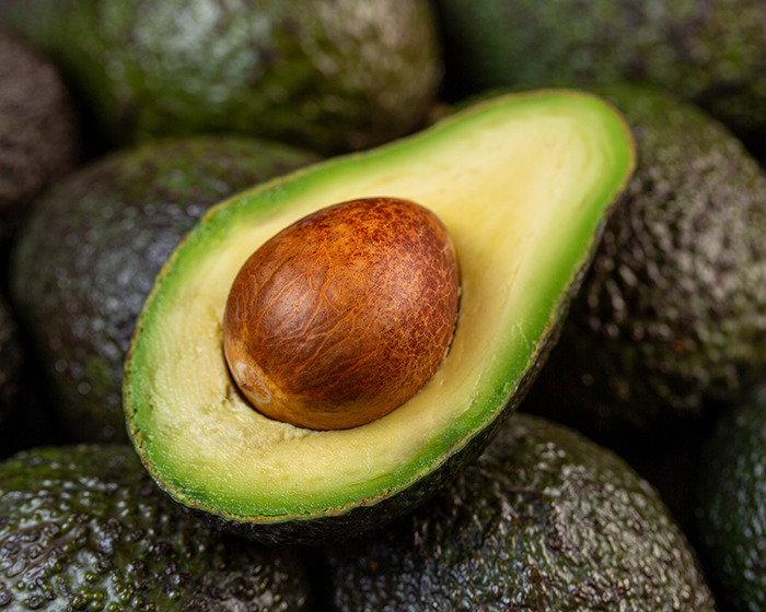 ER Doctor Reveals Many People Are Ending Up In Hospital Over Avocados, Here’s Why ER Doctor Reveals Many People Are Ending Up In Hospital Over Avocados, Here’s Why