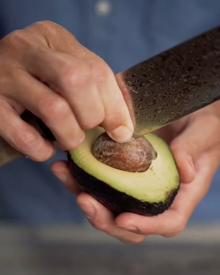 ER Doctor Reveals Many People Are Ending Up In Hospital Over Avocados, Here’s Why ER Doctor Reveals Many People Are Ending Up In Hospital Over Avocados, Here’s Why