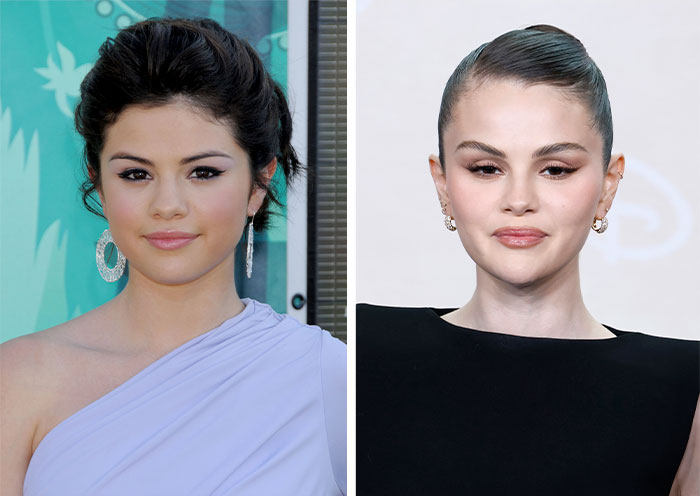“Absolute Tragedy”: Fans Question Selena Gomez’s New ‘Voldemort’ Look Amid Botox Rumors “Absolute Tragedy”: Fans Question Selena Gomez’s New ‘Voldemort’ Look Amid Botox Rumors