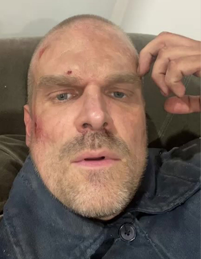 Lily Allen Seemingly Reveals What Really Happened With David Harbour, Leaving Fans Shocked