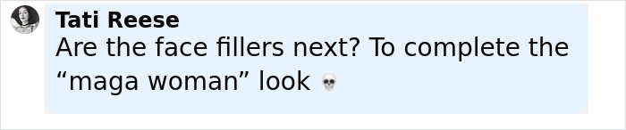 “Are The Face Fillers Next?”: Fans Claim Sydney Sweeney Is Entering Her “MAGA” Era With New Look