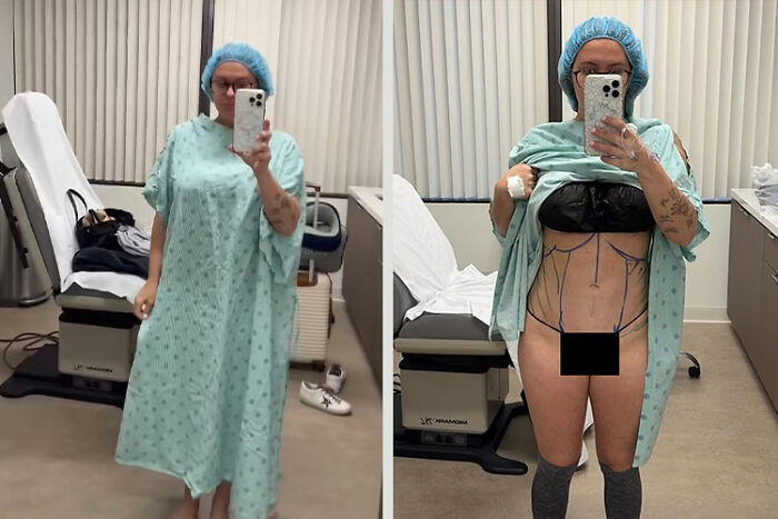 Mom Who Got Her Ribs Broken To Make Waist &#8216;Smaller&#8217; Reveals Transformation In Before-And-After Clips