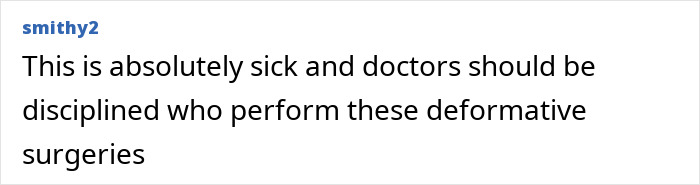 Mom Who Got Her Ribs Broken To Make Waist &#8216;Smaller&#8217; Reveals Transformation In Before-And-After Clips