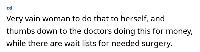 Mom Who Got Her Ribs Broken To Make Waist &#8216;Smaller&#8217; Reveals Transformation In Before-And-After Clips